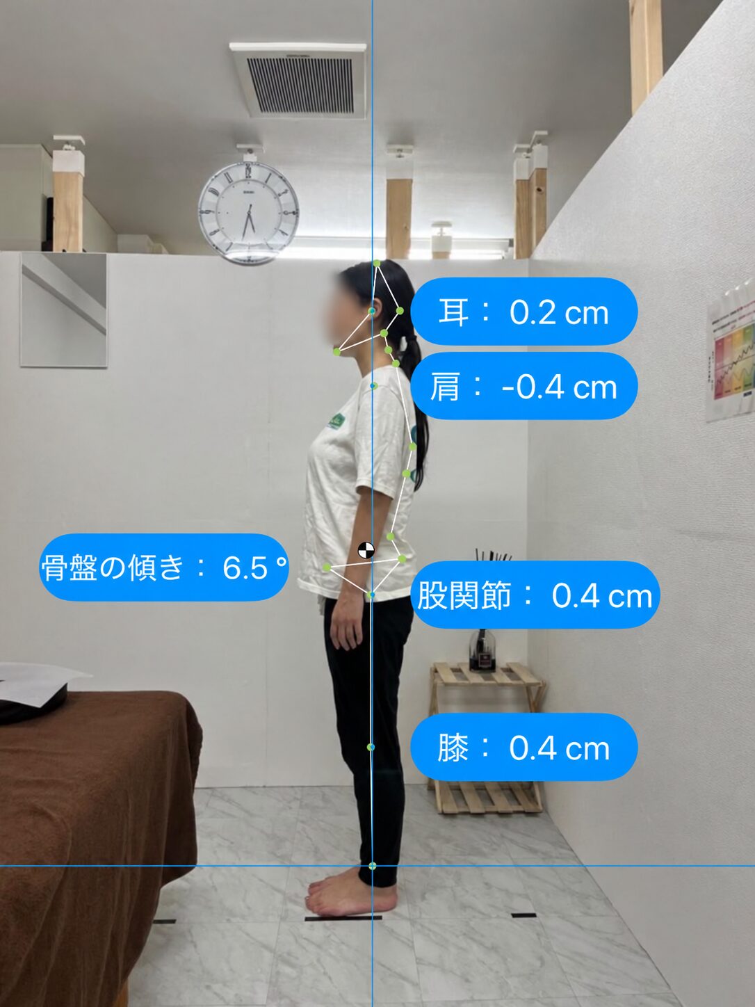 姿勢分析の記録 05 After（顔ぼかし済み）