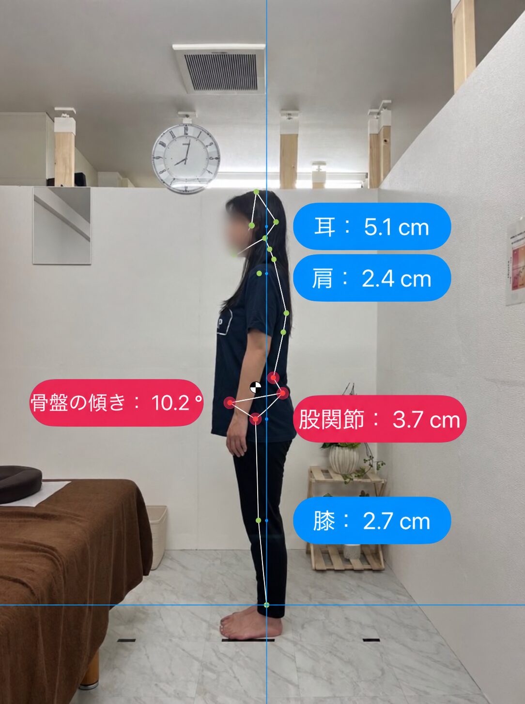 姿勢分析の記録 05 Before（顔ぼかし済み）