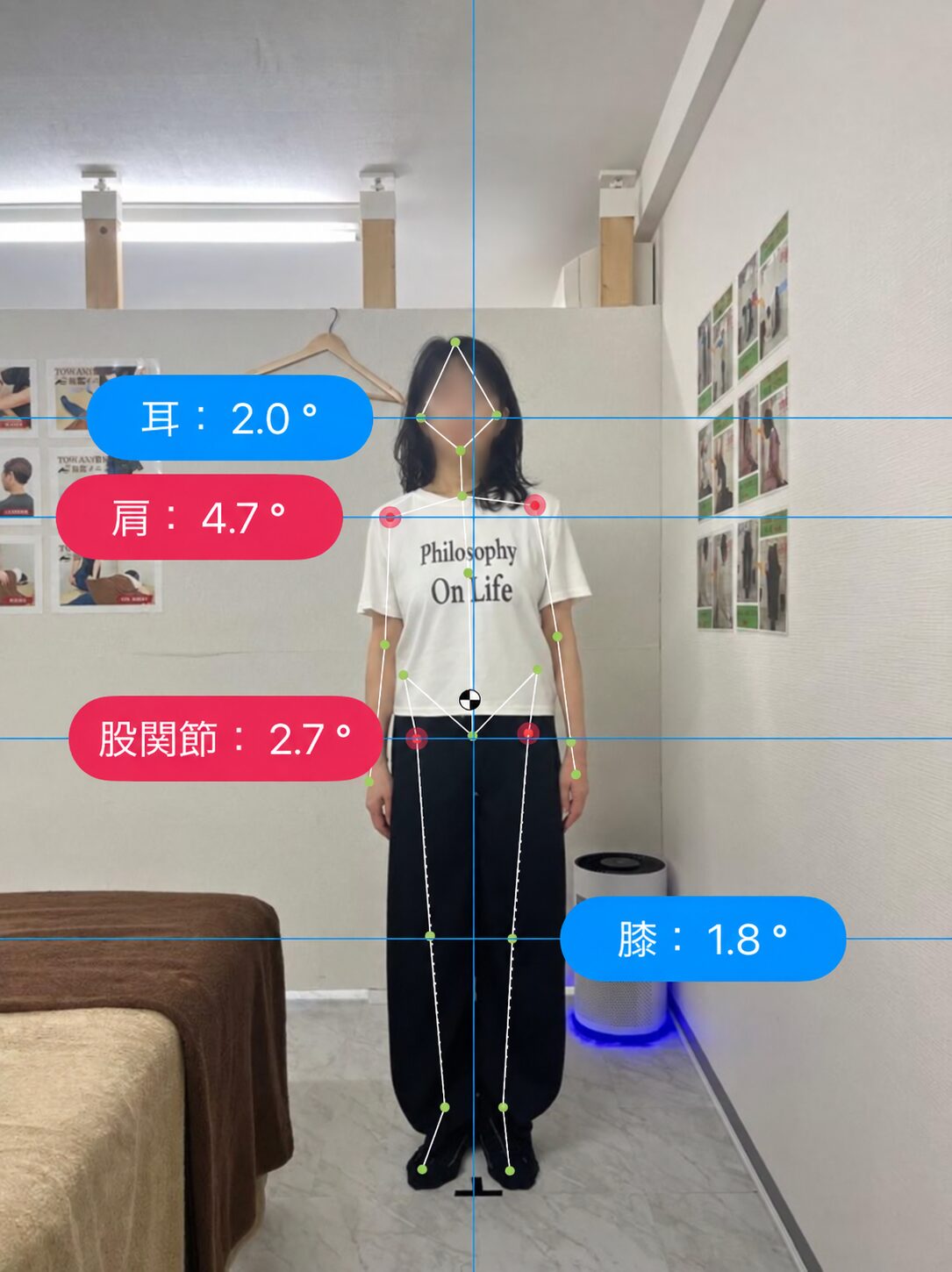 姿勢分析の記録 06 Before（顔ぼかし済み）