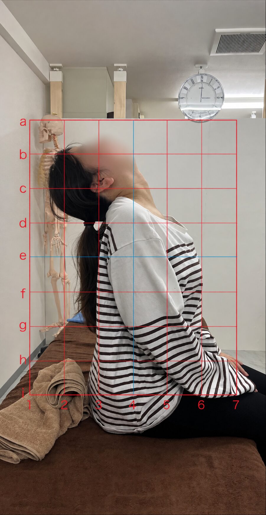 首・背中の動きの記録 After（顔ぼかし済み）