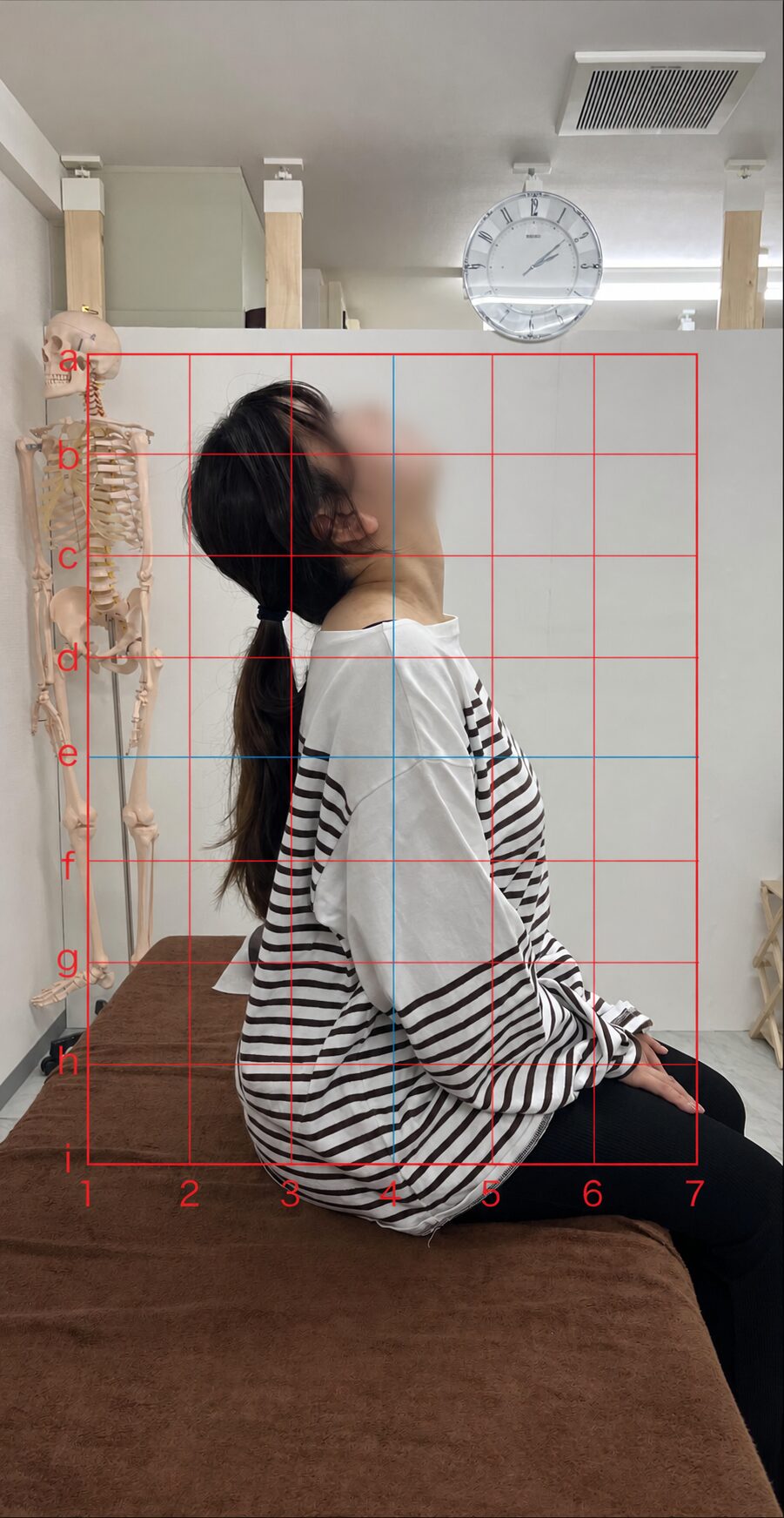 首・背中の動きの記録 Before（顔ぼかし済み）
